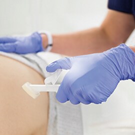 Cavilon Advanced hudskyddsmedel använt på en patient
