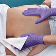 Inkontinensrelaterad dermatit (IAD)