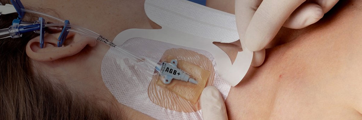 3M™ Tegaderm™ CHG IV förband
