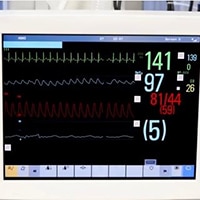 EKG-övervakningslarm