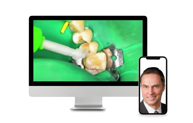Webbinarium om cementering och bindning av dentalmaterial
